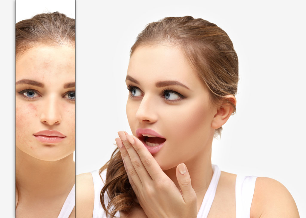 皮膚管理加盟，皮膚管理中心，木乃伊煥膚（二）