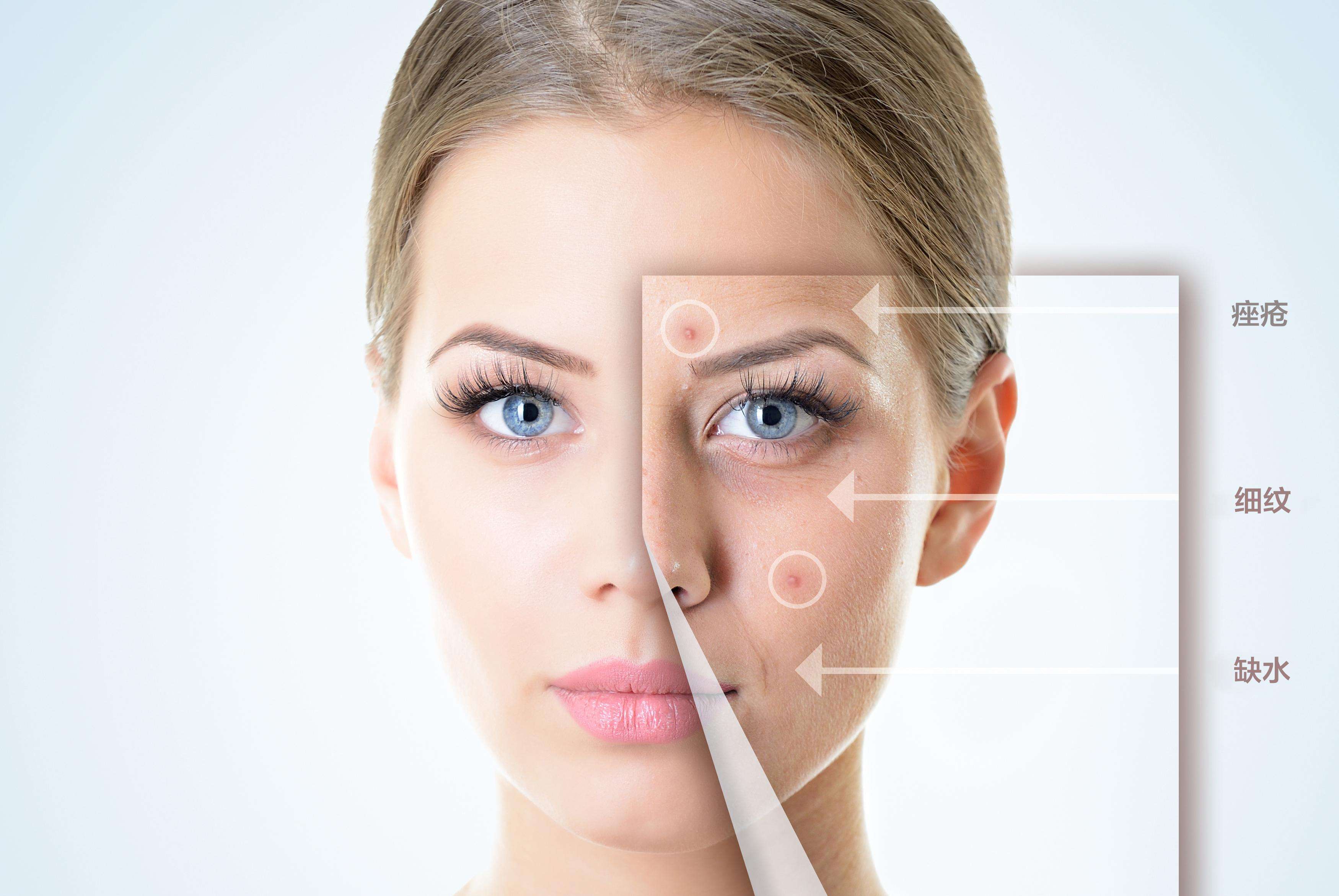 皮膚管理培訓(xùn)，水光注射（二）